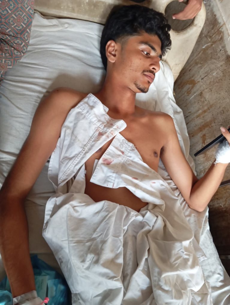 কলেজ ছাত্রদের উপর বহিরাগতদের হামলা, আহত