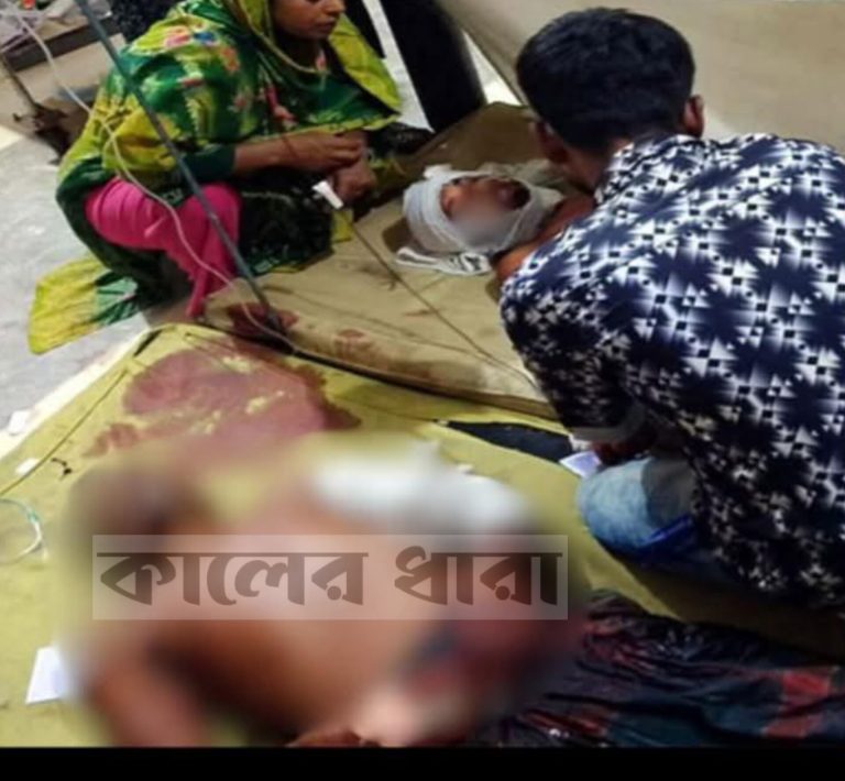 ঝিনাইদহে ভাড়ায় যেতে অস্বীকৃতি, পুত্রকে কুপিয়ে জখম