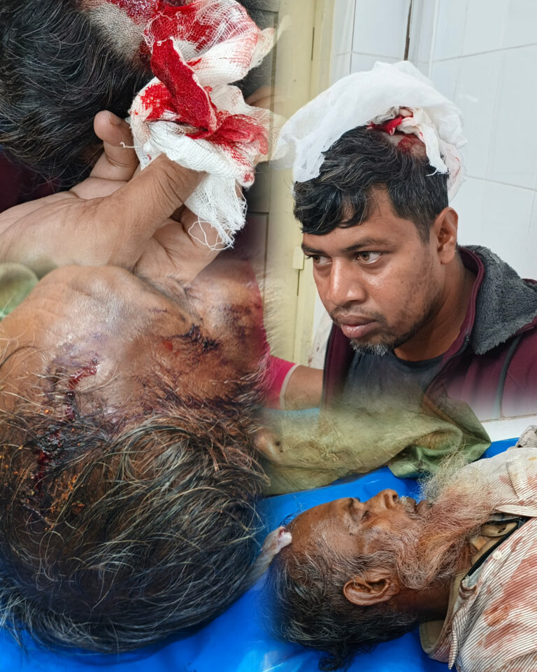 বাবুগঞ্জে জমিতে গরু বাঁধাকে কেন্দ্র করে রক্তক্ষয়ী সংঘর্ষ  একই পরিবারের ৩ জন গুরুতর আহত